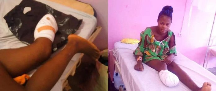 Cameroun un homme coupe le pied de sa femme à cause de la nourriture