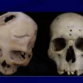 Photo des crânes analysés par l'équipe de chercheurs de l'Université de Saint-Jacques-de-Compostelle en Espagne, publiée le 29 mai 2024. - Universidad USC