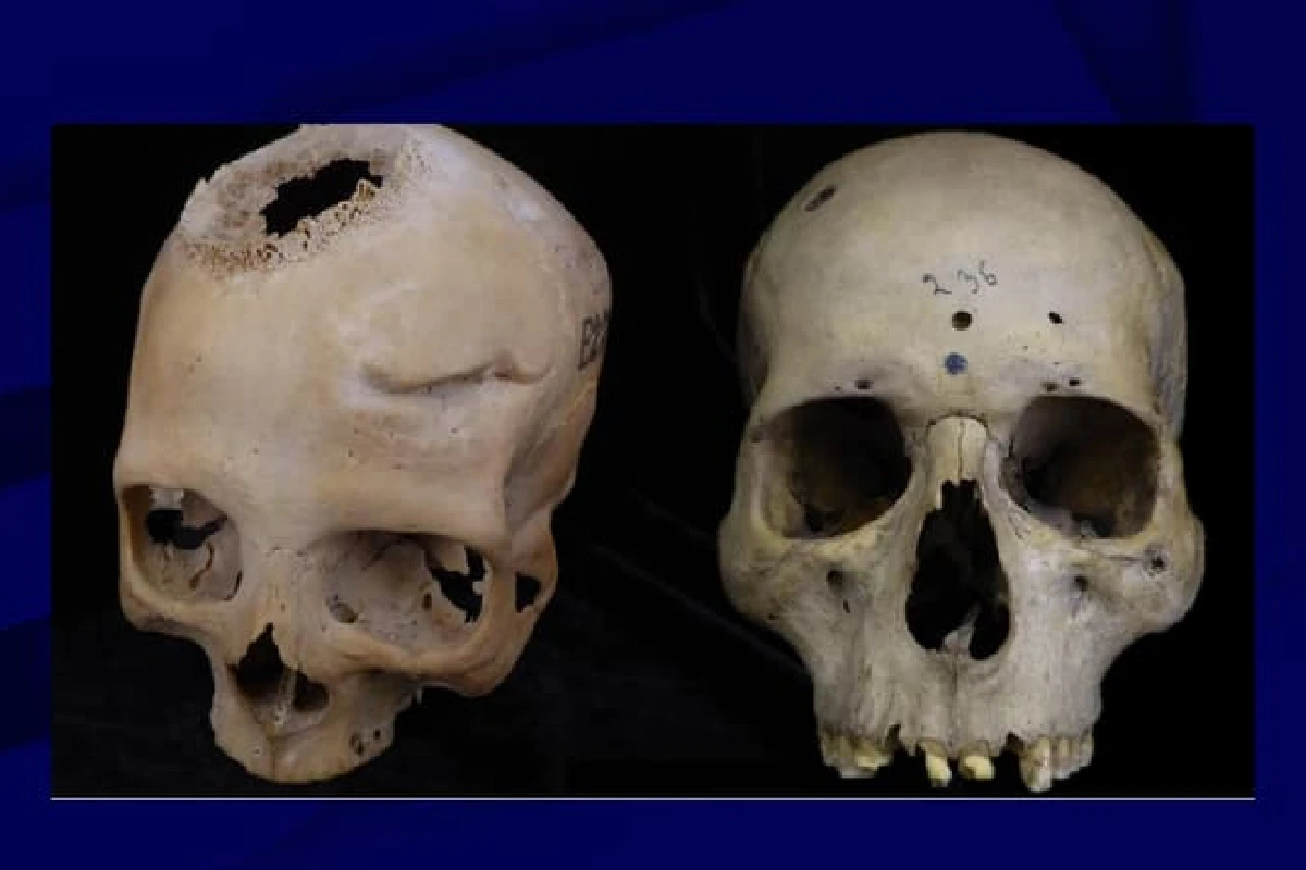 Photo des crânes analysés par l'équipe de chercheurs de l'Université de Saint-Jacques-de-Compostelle en Espagne, publiée le 29 mai 2024. - Universidad USC