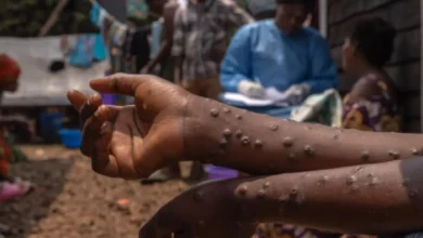 Un patient souffrant de mpox est assis sur un banc de l'hôpital de Kavumu, à 30 kilomètres au nord de Bukavu, dans l'est de la RD Congo, le 24 août 2024. © Glody Murhabazi, AFP